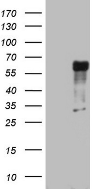 RIP3 Antibody
