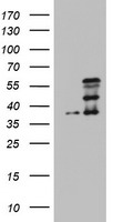 CDCA7L Antibody