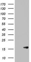 AVPI1 Antibody
