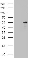 TIPIN Antibody