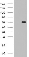 TIPIN Antibody