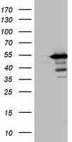 TIPIN Antibody