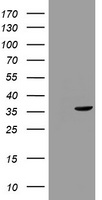 Thymidylate Synthase Antibody