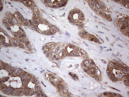 PI 3 Kinase catalytic subunit alpha Antibody