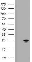ZFAND5 Antibody