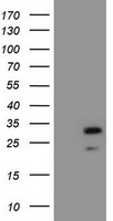 ZFAND5 Antibody