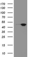 Meis homeobox 3 Antibody