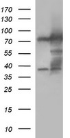 Methylmalonyl Coenzyme A mutase Antibody