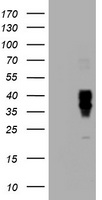CD272 Antibody