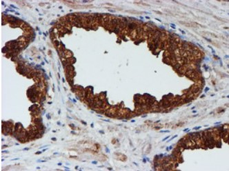 Cystatin C Antibody