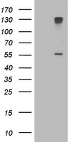 Cytochrome P450 17A1 Antibody
