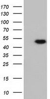 Ribonuclease Inhibitor Antibody
