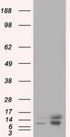 Profilin 1 Antibody