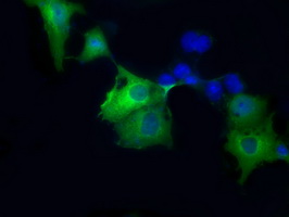 Sorbitol Dehydrogenase Antibody