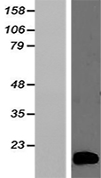 Hbb-b2 (BC032264)Mouse Over-expression Lysate