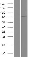 HROB Human Over-expression Lysate