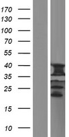 UQCC (UQCC1) Human Over-expression Lysate