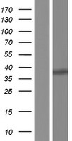 NFYC Human Over-expression Lysate