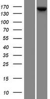 KCP Human Over-expression Lysate