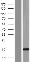 KHDC1L Human Over-expression Lysate