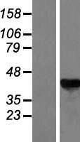 GALK1 Human Over-expression Lysate