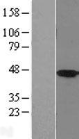 HSD11B2 Human Over-expression Lysate