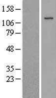 JAK3 Human Over-expression Lysate