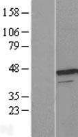 UROD Human Over-expression Lysate