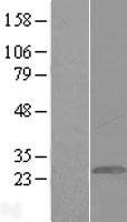 GCAP1 (GUCA1A) Human Over-expression Lysate