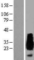APRT Human Over-expression Lysate