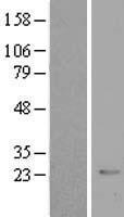 CRYBB2 Human Over-expression Lysate