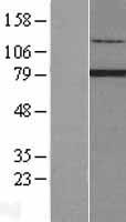 RFX2 Human Over-expression Lysate