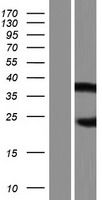 AIRE Human Over-expression Lysate