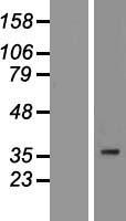 PIM3 Human Over-expression Lysate