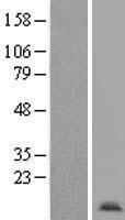 Apc11 (ANAPC11) Human Over-expression Lysate