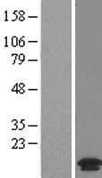 MANBAL Human Over-expression Lysate