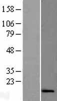DMAC2L Human Over-expression Lysate