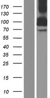 BICD2 Human Over-expression Lysate