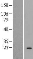 HMGN2P46 Human Over-expression Lysate