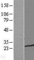 TCEAL1 Human Over-expression Lysate