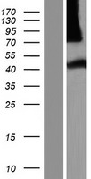 NHLRC3 Human Over-expression Lysate