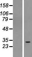 C1orf104 (RUSC1-AS1) Human Over-expression Lysate