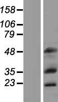 MOX1 (MEOX1) Human Over-expression Lysate