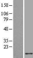 ACBD7 Human Over-expression Lysate