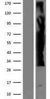 ZFYVE19 Human Over-expression Lysate