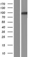USP6NL Human Over-expression Lysate