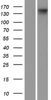 DIAPH3 Human Over-expression Lysate