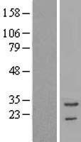 TNNT3 Human Over-expression Lysate