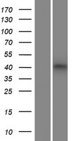 Opn1mw (OPN1MW2) Human Over-expression Lysate
