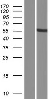 PRAMEF16 Human Over-expression Lysate